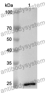 Anti-CD85d/LILRB2 Polyclonal Antibody