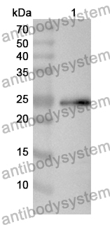 Anti-FTMT Polyclonal Antibody