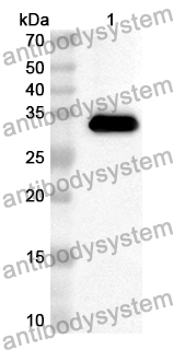 Anti-Human DEFB119 Polyclonal Antibody