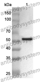 Anti-Human FSIP1 Polyclonal Antibody