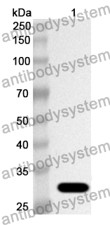 Anti-Human IL17RC Polyclonal Antibody