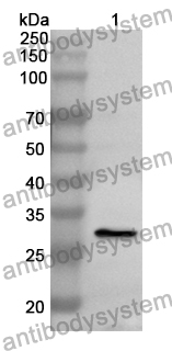 Anti-SUMF1 Polyclonal Antibody