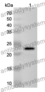 Anti-MCU Polyclonal Antibody