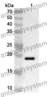 Anti-TRPV1 Polyclonal Antibody