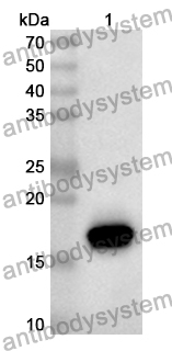 Anti-TRPV3 Polyclonal Antibody