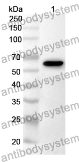 Anti-IL31RA Polyclonal Antibody