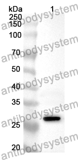 Anti-NFKBID Polyclonal Antibody