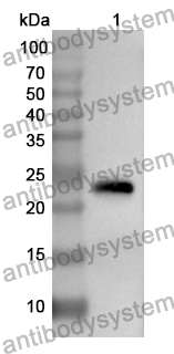 Anti-RNASE11 Polyclonal Antibody