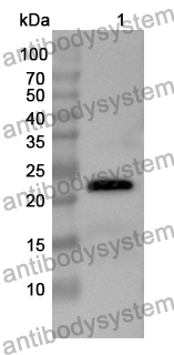 Anti-IL17D Polyclonal Antibody