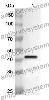 Anti-GPT2 Polyclonal Antibody