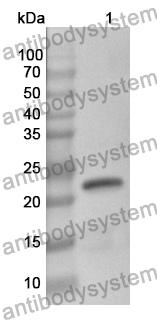 Anti-CD366/HAVCR2/TIM-3 Polyclonal Antibody