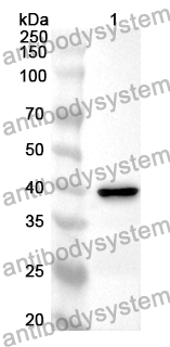 Anti-CEMIP Polyclonal Antibody