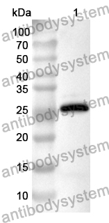 Anti-ITLN1 Polyclonal Antibody