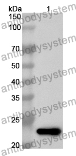 Anti-CYGB Polyclonal Antibody