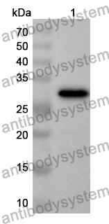 Anti-NEU4 Polyclonal Antibody