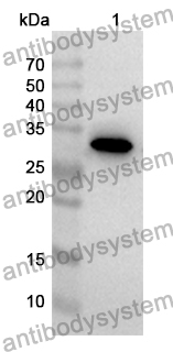 Anti-SYNE2 Polyclonal Antibody