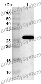 Anti-DDB2 Polyclonal Antibody