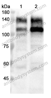 Anti-NCSTN Polyclonal Antibody