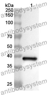 Anti-ESR2 Polyclonal Antibody