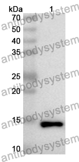 Anti-HAS2 Polyclonal Antibody