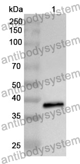 Anti-PCSK5 Polyclonal Antibody