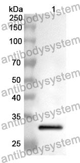 Anti-TANK Polyclonal Antibody