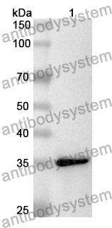 Anti-Human KLK6 Polyclonal Antibody