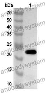 Anti-OSTF1 Polyclonal Antibody