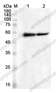 Anti-KAT5 Polyclonal Antibody