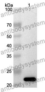 Anti-DVL3 Polyclonal Antibody