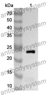 Anti-HGD Polyclonal Antibody