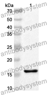 Anti-KISS1R Polyclonal Antibody