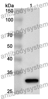 Anti-Human IL22RA2 Polyclonal Antibody