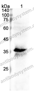 Anti-ST6GALNAC6 Polyclonal Antibody