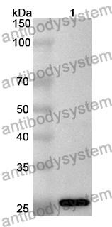 Anti-Human FUBP1 Polyclonal Antibody