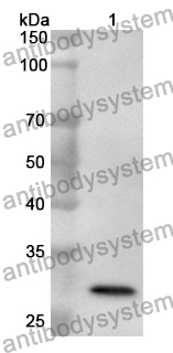 Anti-CD365/KIM-1/TIM-1/HAVCR1 Polyclonal Antibody