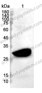 Anti-OTUB2 Polyclonal Antibody