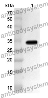 Anti-NEIL1 Polyclonal Antibody