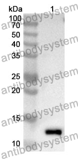 Anti-S100A16 Polyclonal Antibody