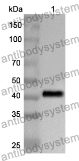 Anti-LRIG1 Polyclonal Antibody