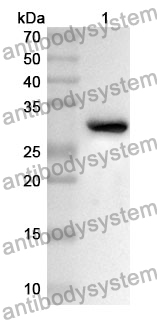 Anti-ELMO2 Polyclonal Antibody