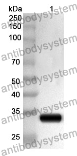 Anti-NR1H4/FXR Polyclonal Antibody