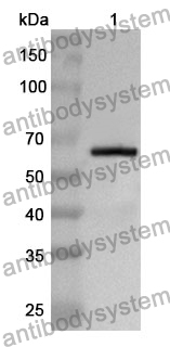 Anti-Human SLC26A8 Polyclonal Antibody