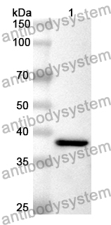 Anti-CAMKK2 Polyclonal Antibody