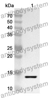 Anti-Human CD114/CSF3R Polyclonal Antibody