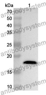 Anti-HBEGF Polyclonal Antibody