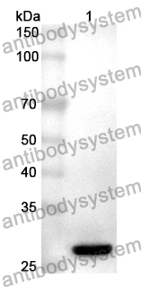 Anti-GAD1/GAD67 Polyclonal Antibody