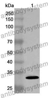 Anti-NOTCH4 Polyclonal Antibody