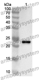 Anti-CD180 Polyclonal Antibody