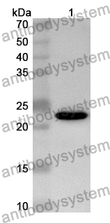 Anti-SDF2 Polyclonal Antibody